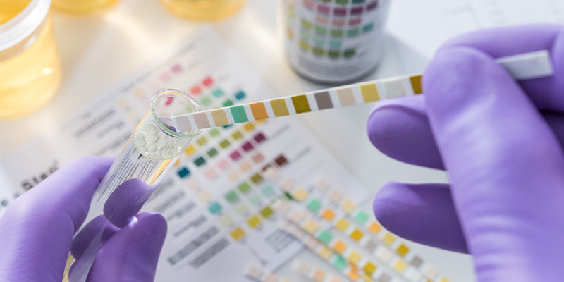 Uk&aacute;že se kratom v testu na drogy?