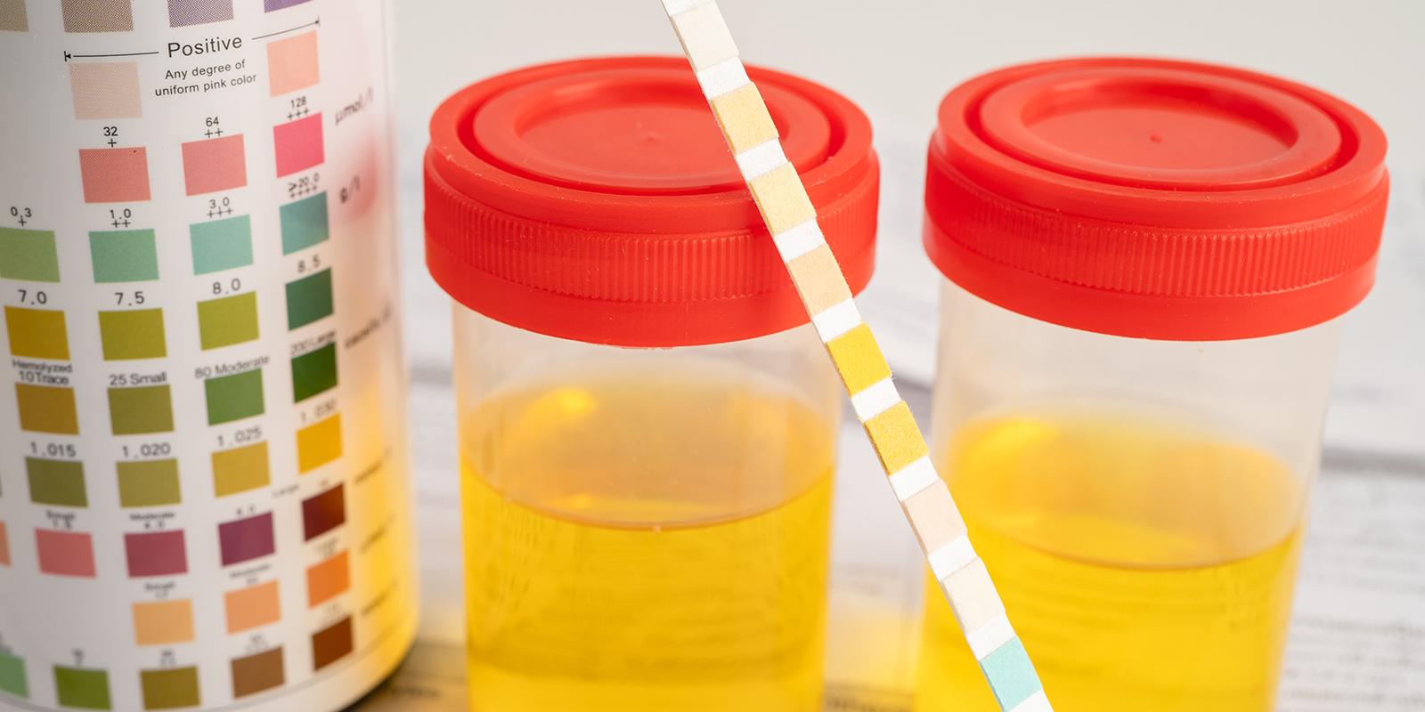 Detekčn&iacute; okna