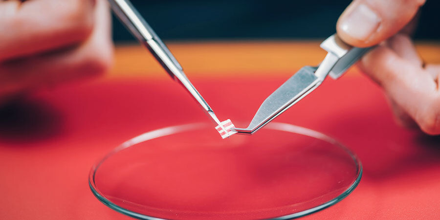 D&aacute;vkov&aacute;n&iacute; LSD