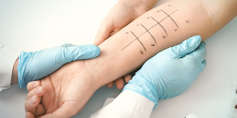 Diagnostika alergie na konop&iacute;