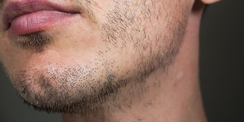 Kanabinoidy, hladina testosteronu a růst vlasů