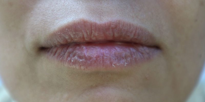 Možn&eacute; vedlej&scaron;&iacute; &uacute;činky kratomu