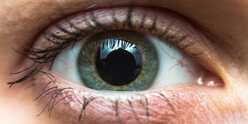 Fyzick&eacute; &uacute;činky