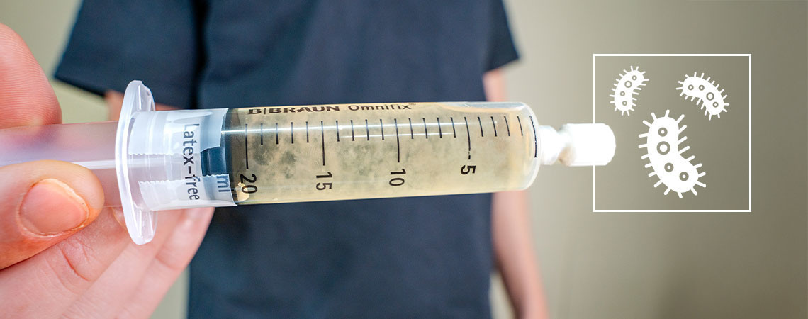 Co je tekut&aacute; kultura? Kompletn&iacute; průvodce pro zač&aacute;tečn&iacute;ky