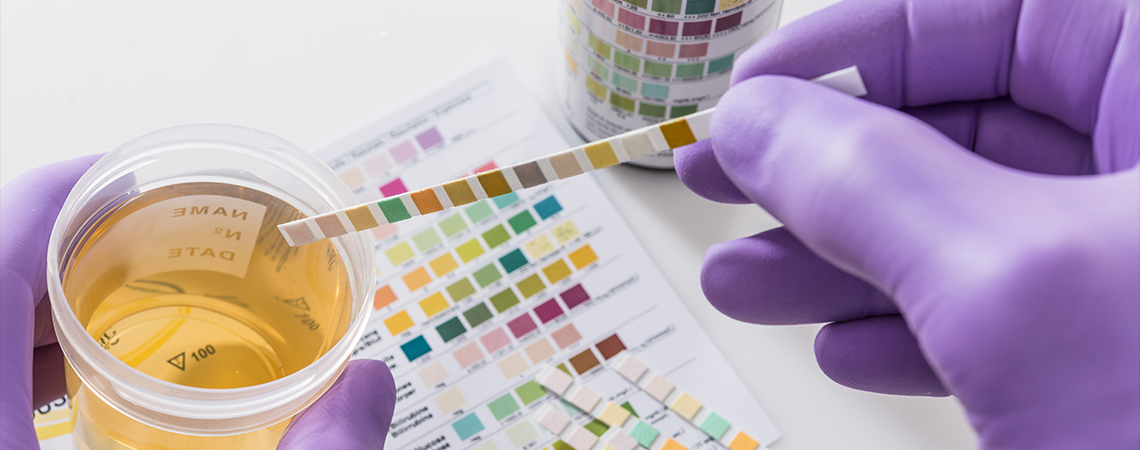 Populární triky vs. realita: Dá se opravdu ošálit test moči na drogy?