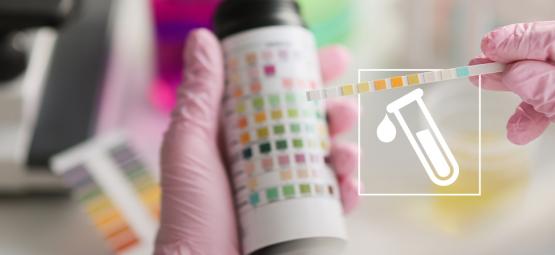 Ukáže se kratom v testu na drogy?