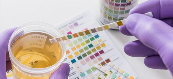 Populární triky vs. realita: Dá se opravdu ošálit test moči na drogy?