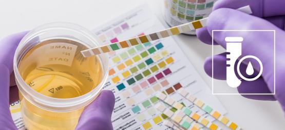 Jak projít testem na THC (2026)